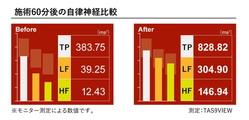 施術60分の自律神経比較写真
